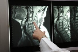 A nyak röntgenképe