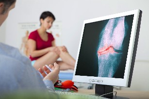osteoarthritis diagnózis
